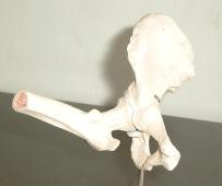 hip joint outwards